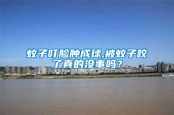蚊子叮臉腫成球,被蚊子咬了真的沒(méi)事嗎？