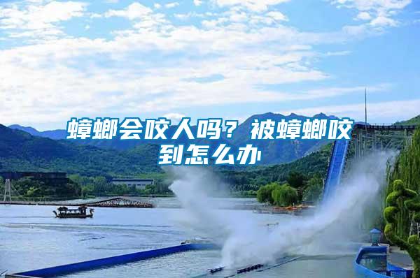蟑螂會咬人嗎？被蟑螂咬到怎么辦